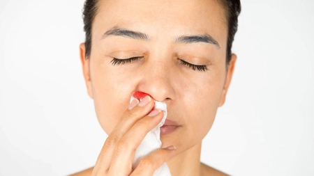 Ce înseamnă când îti curge sânge din nas din senin: 4 posibile variante