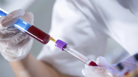 Hemoglobina: nivel scazut sau mare, ce inseamna?