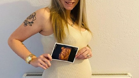 Ecografia 4D a unui bebeluș a ajuns virală. Ce a observat medicul