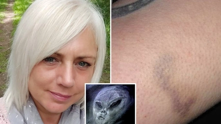 Dezvăluiri șocante! O femeie afirmă că a fost răpită de extratereștrii. Aceasta are dovezi care-i susțin afirmațiile