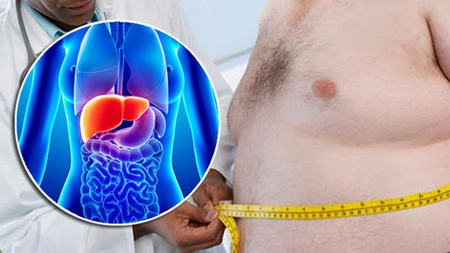 Antidotul ficatului gras. Sucul care curăţă ficatul în 72 de ore și întăreşte imunitatea