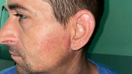 Un bărbat din Gorj ar fi fost bătut de mai mulți jandarmi şi poliţişti. Brancardierul are urme de bocanci pe față - FOTO