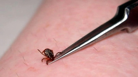 Cum se scoate o căpușă: Ce sfaturi de ne dau medicii