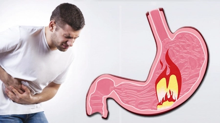 Regim pentru gastrită: Ce recomandă medicii specialiști