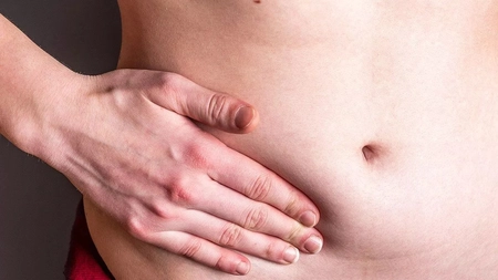 Hernia inghinală fară operație: Sfatul medicului și remedii naturiste