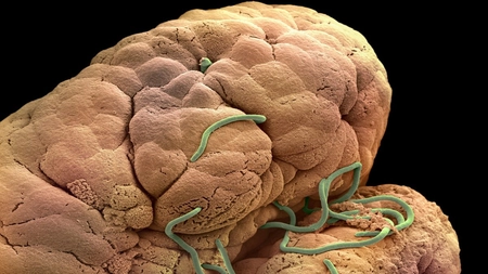 Infestare cu oxiuri la copii: Simptome și tratament