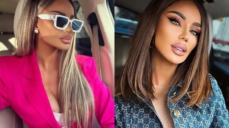Bianca Drăgușanu și-a injectat din nou buzele. Ce altă intervenție și-a mai făcut vedeta