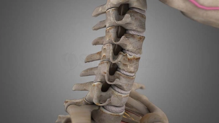 Exerciții pentru spondiloză cervicală. Sfatul medicilor