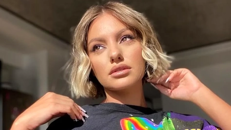 Alexandra Stan a recunoscut că suferă de o boală autoimună fără leac
