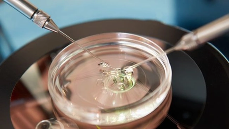 Programul de fertilizare in vitro. Femeile peste 40 de ani ar putea să nu mai beneficieze de procedură
