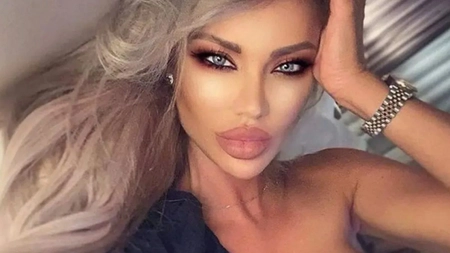 Bianca Drăgușanu pare să nu se mai sature de operații estetice. Cum arată acum: „O formă cât mai voluminoasă”