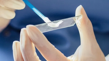 Scapă de candidă în 48 de ore. Tratamentul sigur pentru a scăpa de infecția vaginală