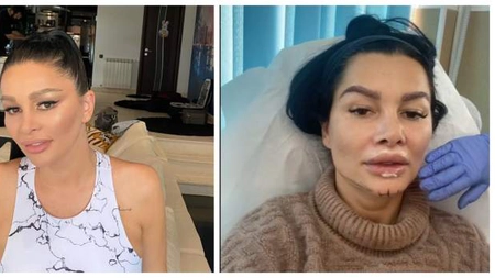 Brigitte Pastramă, la un pas de moarte din cauza intervențiilor estetice: „Am făcut embolie pulmonară