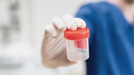 Coagulare intravasculară diseminată. Cum poate fi vindecat sindromul