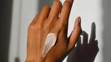 Creme pentru arsuri din ingrediente 100% naturale. Cum să le prepari acasă