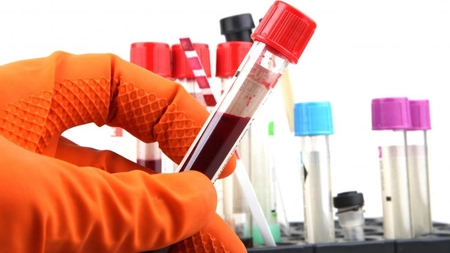 Testul de sânge care ar putea depista cancerul înainte de orice simptom
