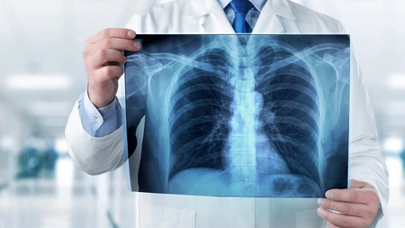 Un bărbat din India s-a prezentat la spital pentru că se simțea foarte balonat. Ce au găsit medicii în stomacul lui