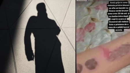 Un tânăr de 30 de ani terorizează cu un cuțit copiii din cartierul Dacia! Bărbatul intră în scările de bloc, încercând să-i abuzeze sexual - FOTO