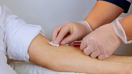 Ce afecțiuni indică hematocritul mărit? Interpretarea analizelor medicale