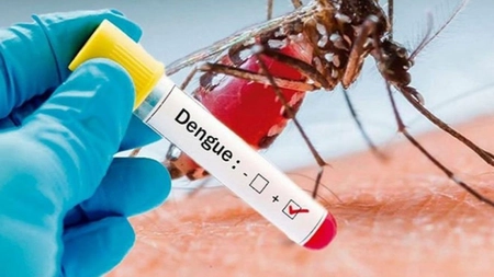 O femeie din Marea Britanie s-a infectat cu febră dengue în Franţa