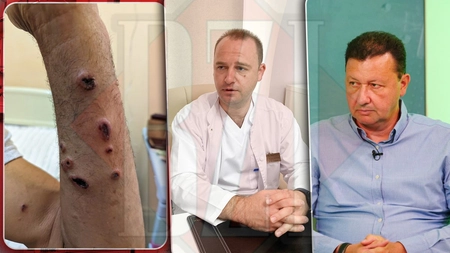 Alertă în Iași! DSV a declanșat o anchetă în cazul celor trei bărbați internați la Spitalul de Boli Infecțioase, diagnosticați cu antrax - FOTO