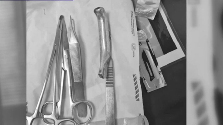 Coșmar pentru un bărbat din Prahova. Medicul i-a uitat în rană mânerul frânei de la bicicletă