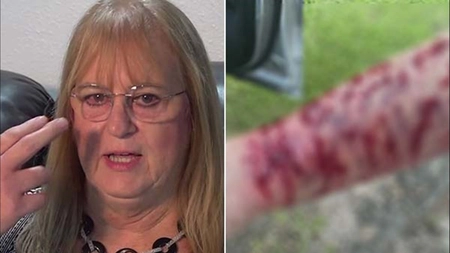 O femeie din Texas a fost atacată concomitent de un șarpe și un șoim: „Aveam răni, tăieturi, abraziuni, zgârieturi şi vânătăi serioase”