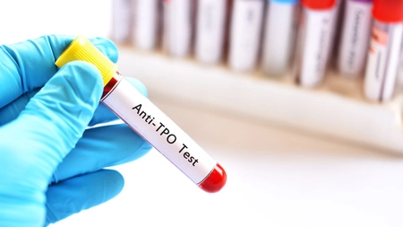 Care sunt valorile normale Anti-TPO.  Care este semnificația acestora în sănătatea tiroidiană