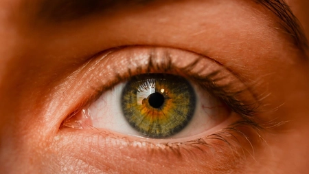 Ce se întâmplă dacă ai un vas de sânge spart la ochi