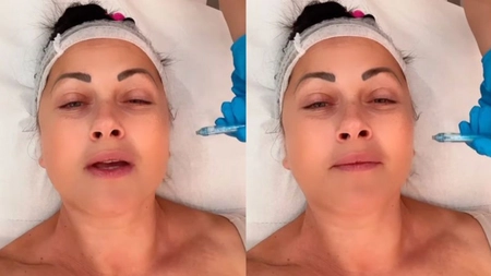 Gabriela Cristea, tratament de înfrumusețare dar fără bisturiu. Ce intervenție și-a făcut vedeta