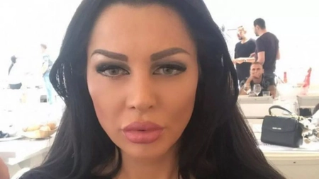 Brigitte Pastramă și-a scos acidul hialuronic din buze! Cum au reacționat internauții când au văzut imaginile