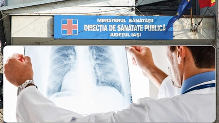 Pneumoniile fac ravagii în rândul ieșenilor! Au fost înregistrate peste 800 de cazuri în doar o săptămână