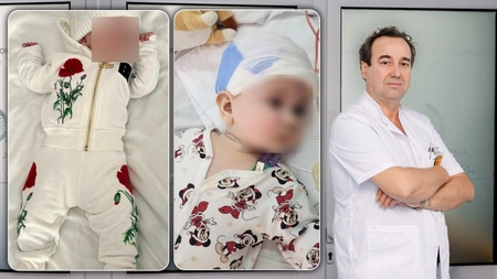 Fetița de doar 7 luni a trecut cu bine de cea de-a cincea intervenție chirurgicală la nivelul creierului. Medicii ieșeni spun că evoluția este bună - FOTO