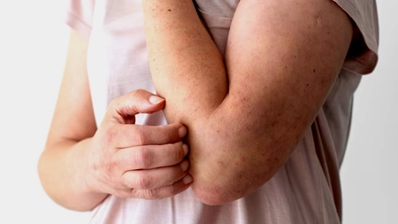 Ce întreține inflamația în organism. Analizele care indică prezența agenților patogeni