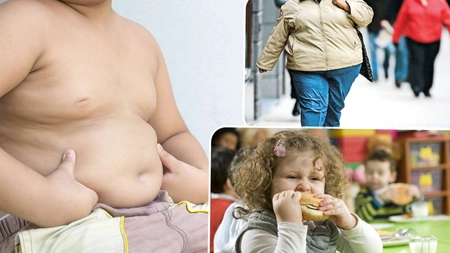 Până în anul 2035, numărul persoanelor care suferă de obezitate va crește într-un ritm accelerat. Specialiștii trag un semnal de alarmă – FOTO