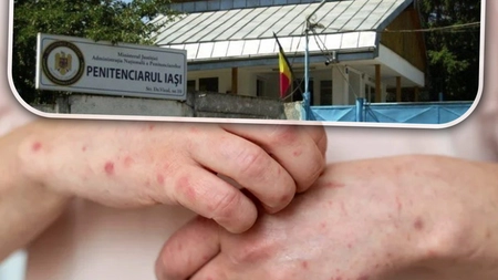 Administrația Națională a Penitenciarelor confirmă dezastrul din Penitenciarul Iași! Oficial: mai mulți deținuți s-au umplut de scabie: „Au fost raportate șase cazuri” - FOTO