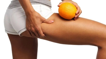 Celulita. Cinci secrete și trucuri pentru a o elimina în mod natural