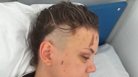 Emily Burghelea, rasă pe cap înainte de operație! „Moartea ne-a făcut cu mâna!“