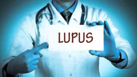 Alimente interzise în lupus. Care este alimentația de care trebuie să ții cont