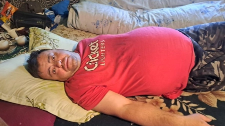 Acest bărbat trăiește, de 6 luni, un adevărat coșmar! Din cauză că burta îi crește de la o zi la alta, Mihai Burlacu nici nu se mai poate încălța singur