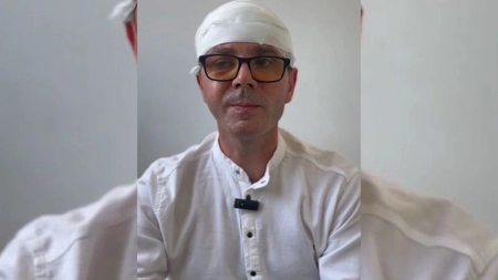 A început să vadă rău cu ochiul drept și credea că are nevoie de ochelari! Medicii i-au dat însă o veste proastă, problema sa era mult mai gravă, deoarece avea o tumoră extrem de rară