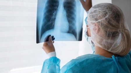 Ce este boala plămânului alb? Nu este un virus, ci o bacterie atipică!