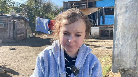 Mihaela Gafa a fost nevoită să renunțe la școală, deoarece colegii și profesorii râdeau de boala sa: „Îmi spuneau că miros urât”