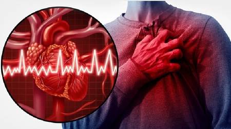 Ce simți când faci infarct? Iată primul lucru pe care trebuie să îl faci