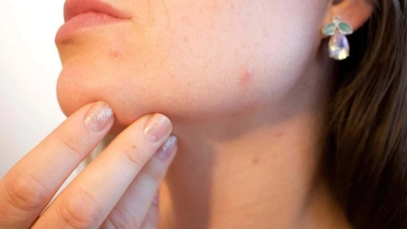Poți face baie când ai varicelă? Sfaturi de care să ții cont