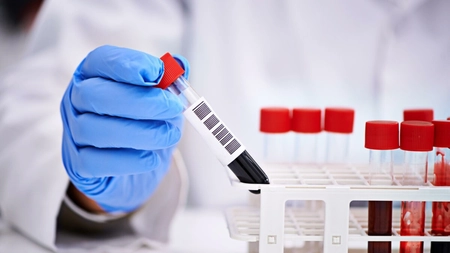 Iată ce analize sunt gratuite cu trimitere de la medicul de familie