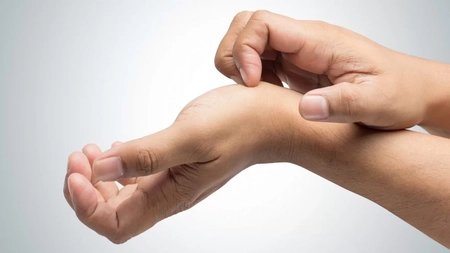 Eczema dishidrotică afectează mai multe femei decât bărbați. Poze, simptome, cauze și tratament