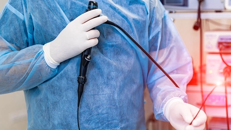 Endoscopie digestivă. Care sunt beneficiile procedurii în diagnosticarea și tratarea bolilor