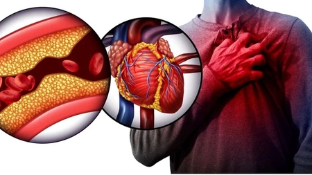 Ce să mănânci pentru scăderea colesterolului fără medicamente. Află ce probleme de sănătate poate provoca hipercolesterolemia!