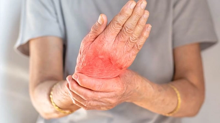 Poliartrita reumatoidă este cancer? Află dacă este sau nu ereditară!